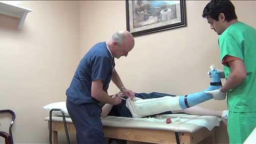 膝踝足矫形器的取形