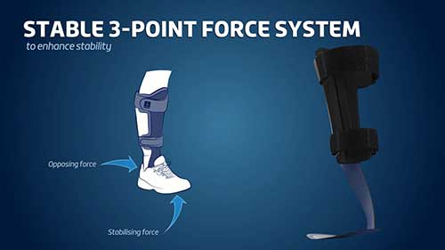 法国图安动态踝足矫形器