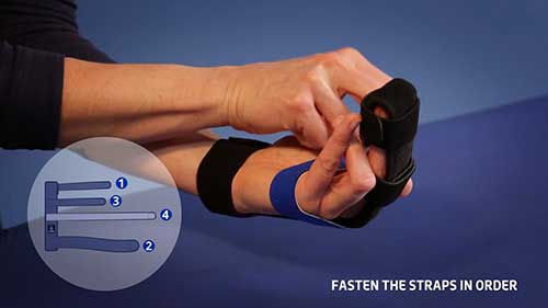 腕指矫形器的穿戴方法