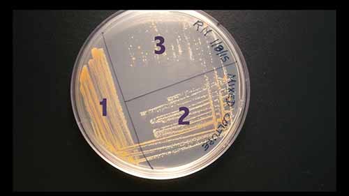 传染病实验室：菌种分离