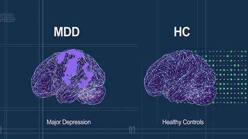 药物发现和开发