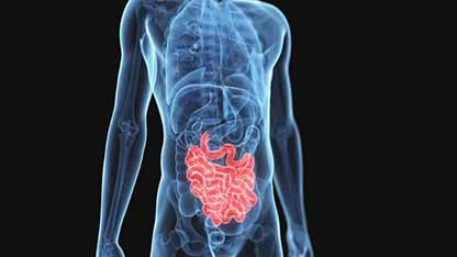 饮食健康与克罗恩病