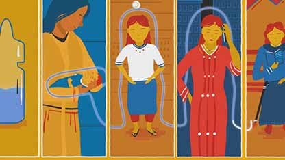 疫苗衍生脊灰病毒