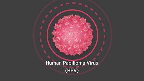 宫颈癌与HPV疫苗