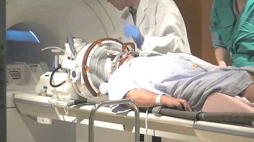 聚焦超声与脑部疾病