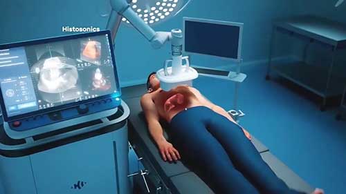 聚焦超声与癌症治疗