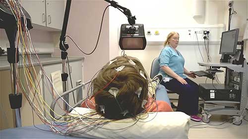 儿童脑电图检查