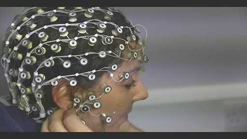 脑电图基础知识