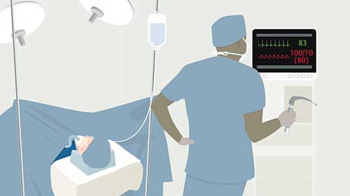 连续无创血压监测