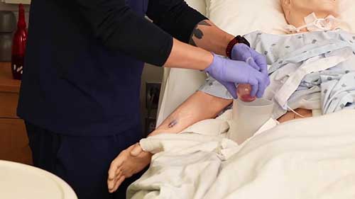 伤口护理——伤口引流管