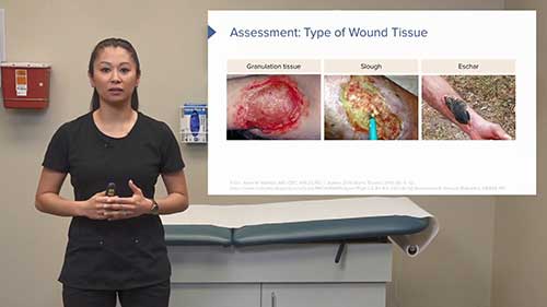 如何进行伤口评估