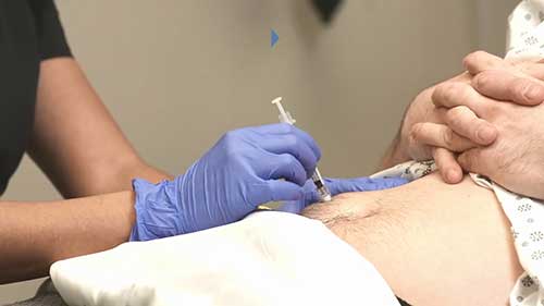 如何进行腹部皮下注射