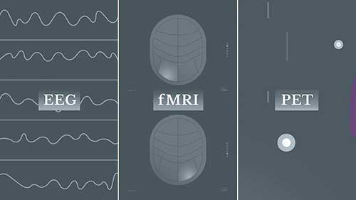 三种检查脑部的技术