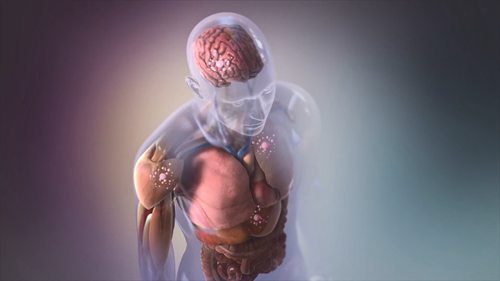 体细胞基因组编辑项目