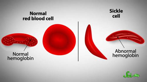 血液疾病的基因疗法