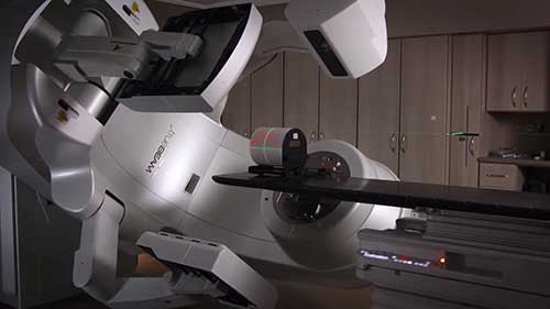 立体定向放疗治疗动静脉畸形