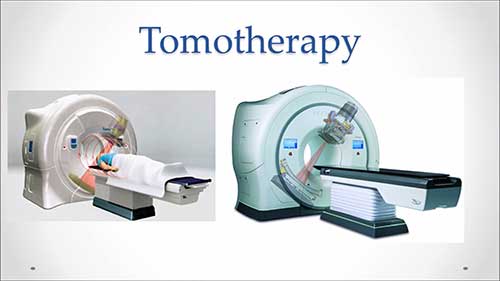 体部立体定向放疗在肺癌中的应用