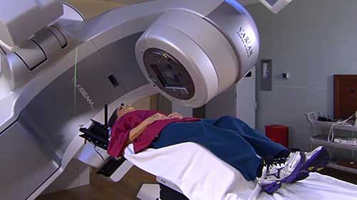 什么是调强放疗