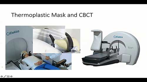 伽马刀放射外科手术详解