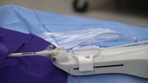 乳腺癌术中放射治疗演示