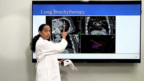 间质近距离放射治疗的应用