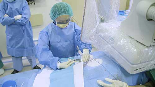 钇90（Y90）选择性内放射治疗