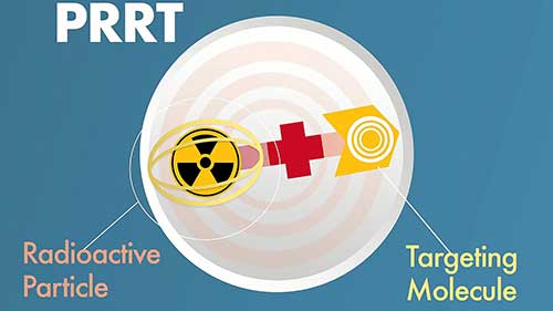 肽受体放射性核素疗法概述