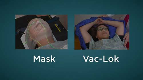 有关CT模拟定位的基本知识