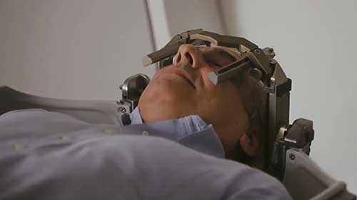 放疗患者的体位固定