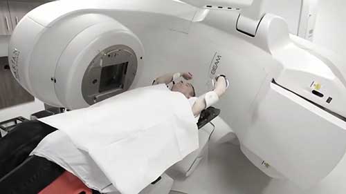 放射治疗：完成治疗