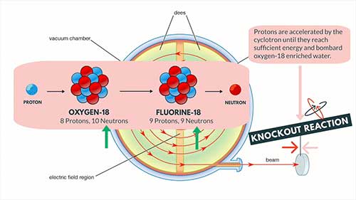 什么是放射性示踪剂