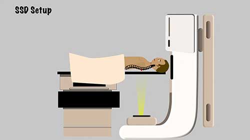 放疗剂量学：影响剂量计算的因素