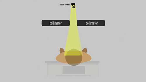 放疗剂量学：光子束半影