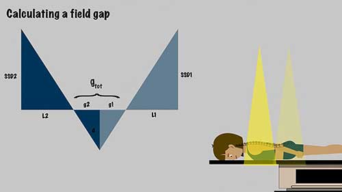 放疗剂量学：光子辐射场匹配