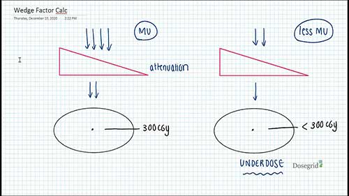 剂量计算：楔形因子计算