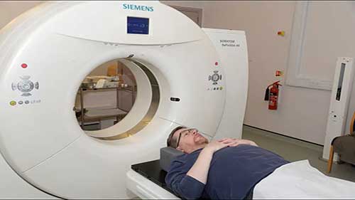 前列腺癌放射治疗计划