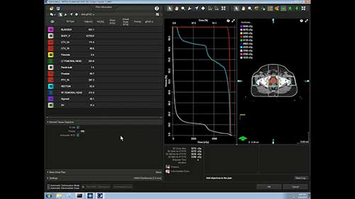 Eclipse放疗计划系统：调强放疗计划