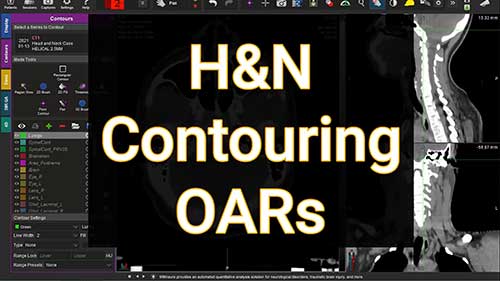 头颈部危及器官的勾画01