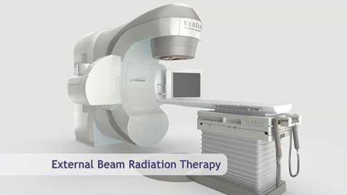 什么是外照射治疗