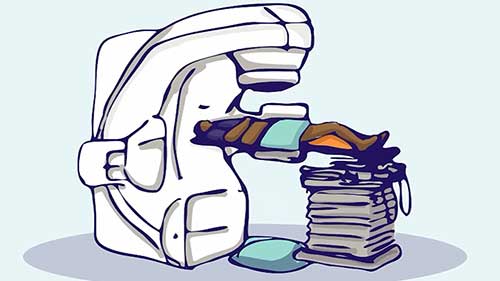 前列腺癌外照射治疗