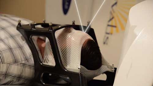 立体定向放射治疗流程