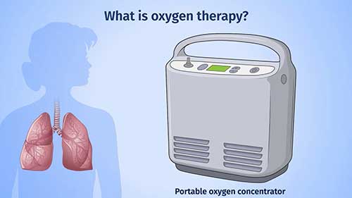 使用便携式氧气浓缩器
