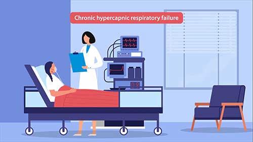 经鼻高流量氧疗的应用