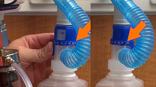 气管切开术患者的氧气输送