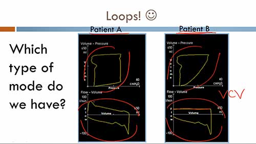 机械通气：呼吸环