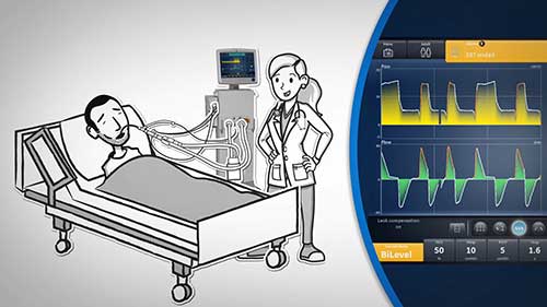 在重症监护室脱离机械通气