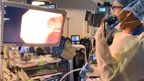 支气管镜知识讲座