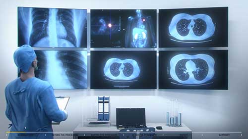 超声支气管镜检查：流程介绍