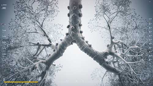 超声支气管镜检查：操作指导