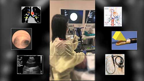 超声支气管镜检查与肺癌纵膈分期